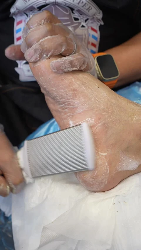 Professional Foot Care Session Stock Footage 314901264