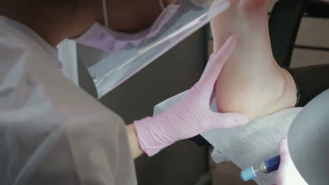 Professional hardware pedicure using electric machine. Heel peeling Vidéo 100955732