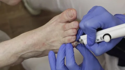 Professional hardware pedicure using an electric device. Stock-Footage 148276752