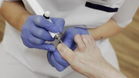Professional hardware pedicure using an electric device.Podiatry clinic. Stock Footage 148955316