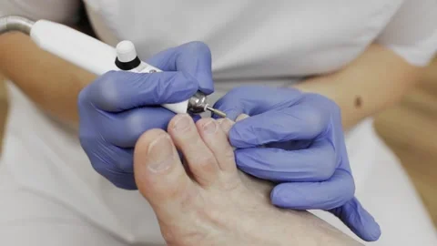 Professional hardware pedicure using an electric device. Stock-Footage 148955388