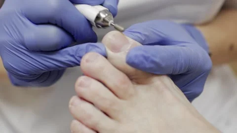 Professional hardware pedicure using an electric device. Stockbeeldmateriaal 149242365