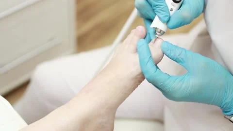 Professional hardware pedicure using an electric device.Podiatry clinic. Stock-Footage 151276866