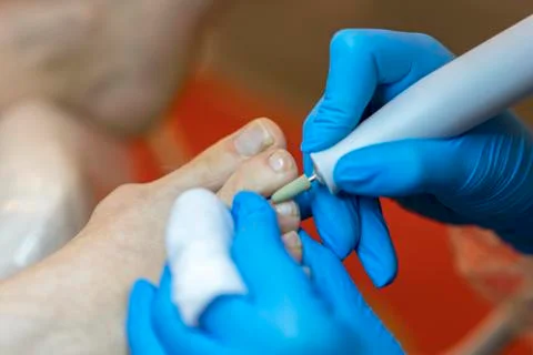 Professional hardware pedicure using electric machine.Patient on medical pedi Stock Photos