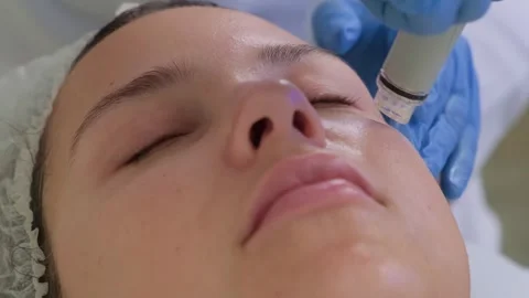 Professional hardware procedures. Hydrafacial massage process. Vídeos de archivo 250083488