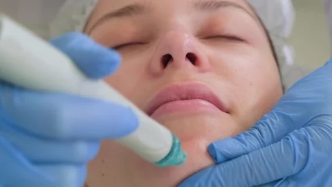 Professional hardware procedures. Hydrafacial massage process. Stockbeeldmateriaal 250169888
