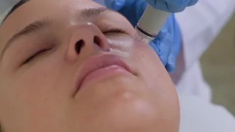 Professional hardware procedures. Hydrafacial massage process. Stock Footage 253976924