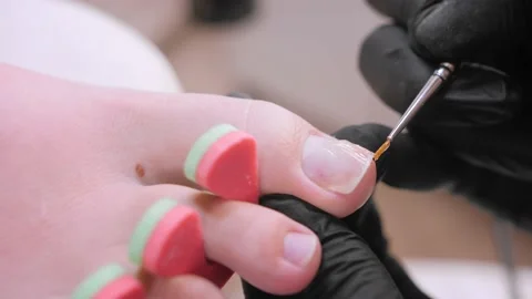 Professional master aligns shape of toenail using base Stock Footage 238622176