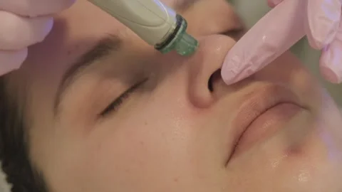 Professional moisturizing and rejuvenating hardware procedures. Stock Footage 316131376