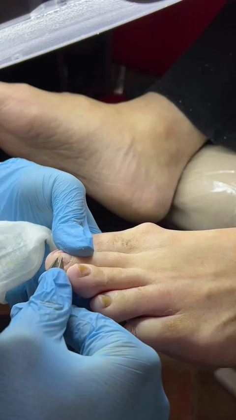 A professional pedicure procedure is taking place. A male foot is being treated Stock Footage 318390405