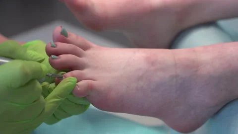 A professional pedicurist performs the procedure for removing old toenails. Girl Stock Footage 155993140