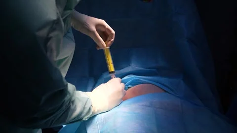 Professional plastic surgeon injecting purified fat into the patient's buttocks Stock Footage 345682141