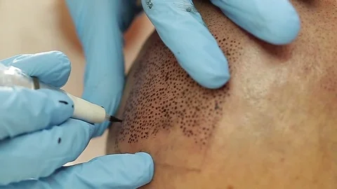 Professional tattooist making permanent make up tricopigmentation Stock Footage 73677367