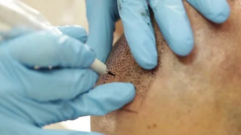 Professional tattooist making permanent make up tricopigmentation Stock Footage 73677382