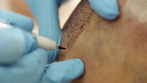 Professional tattooist making permanent make up tricopigmentation Stock Footage 73677482