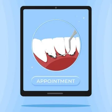 Professional teeth cleaning vector illustration. Book an appointment Stock Illustration
