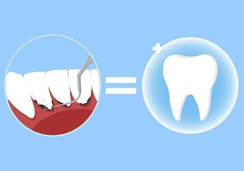 Professional teeth cleaning vector illustration. Book an appointment Stock Illustration