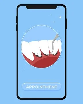 Professional teeth cleaning vector illustration. Book an appointment Stock Illustration