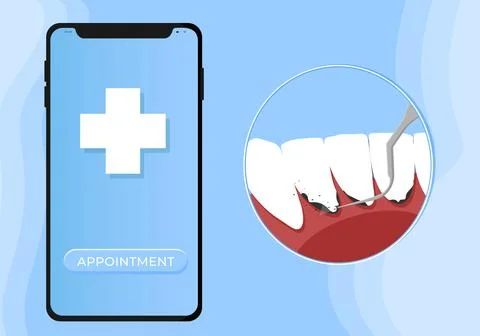 Professional teeth cleaning vector illustration. Book an appointment Stock Illustration