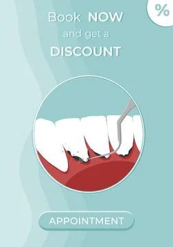 Professional teeth cleaning vector illustration. Discount on teeth cleaning Stock Illustration