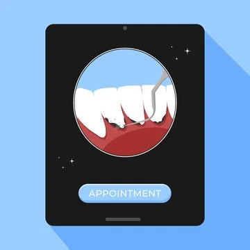 Professional teeth cleaning vector illustration. Book an appointment 스톡 일러스트