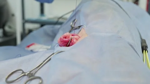 Professional veterinarian performing a castration surgery on a male dog in a 스톡 동영상 341704474