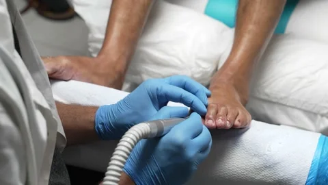 Proffesional Medical pedicure Stock Footage 155017444