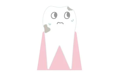 Progress of tooth decay, tooth surface begins to melt Stock Illustration