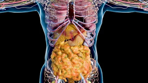 Progressive Accumulation of Visceral Fat and Fatty Liver Disease Vidéo 337696232