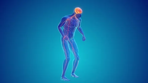 Progressive Central Nervous System Degeneration or Parkinson's disease Stock-Footage 282663375