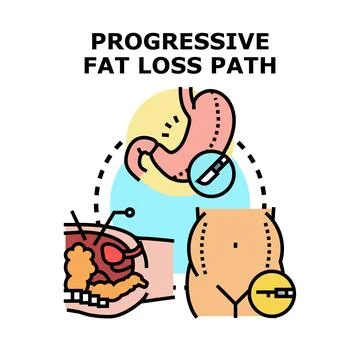 Progressive fat loss path illustrating surgical procedures Stock Illustration