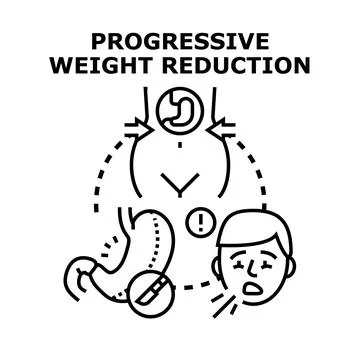 Progressive weight reduction concept with bariatric surgery Stock-Illustration