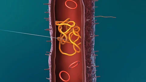 Prokaryotic cell Stock Footage 322998656