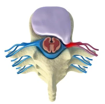 Prolapse of intervertebral disc. Top view Ilustração Stock