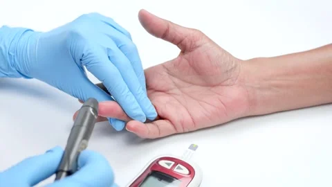 Proper blood collection methods can be presented for use in hospitals. Stock Footage 244382185