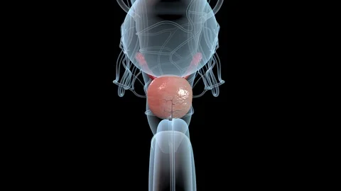 Prostate Cancer Video stock 122502865