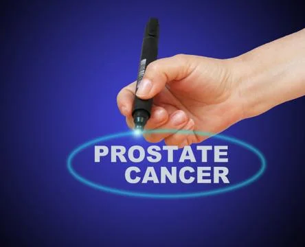 Prostate cancer Stock Illustration