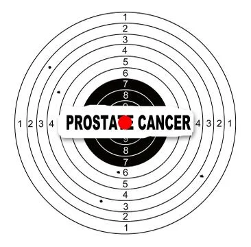 Prostate cancer Ilustración de archivo