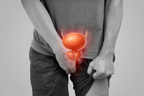 Prostate or urinary tract issue concept in men, health risk warning. Foto stock