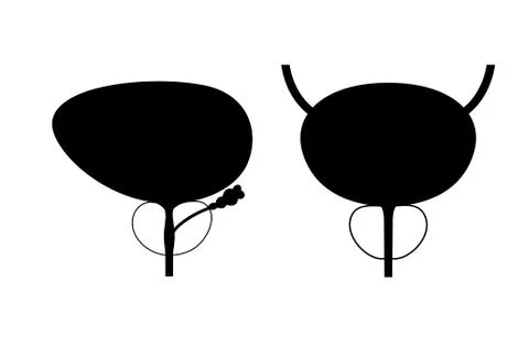 Prostatitis inflammation problem Stock Illustration