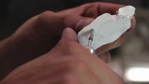 Prosthesis for hands. Assembly of a prosthetic hand in the garage Stock Footage 171884451