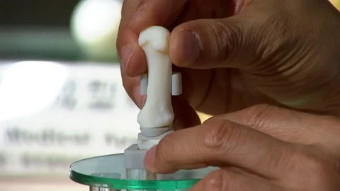 Prosthesis for the metacarpal bone printed in 3D. Smartphone thumb. Stock Footage 81850773