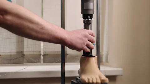 Prosthetic foot, precision alignment, rehab clinic Stock Footage 340292817
