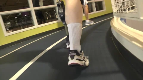 Prosthetic leg recipient walking front and rear view Vidéo 34091927