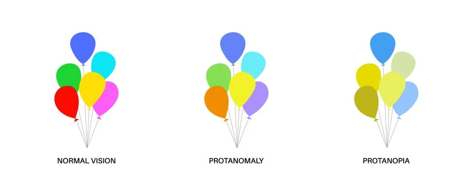Protanomaly and protanopia Stock Illustration