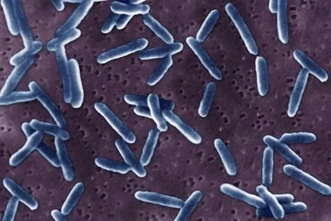 Proteus morganii A SEM view: scanning electron microscope. Copyright: xSTx... Stock Photos