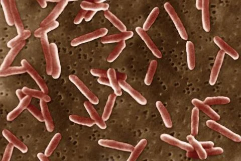  Proteus morganii Viewed under scanning electron microscope (SEM). Copyrig... Stock Photos