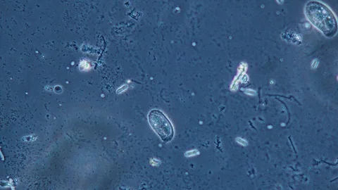 Protista FaseContrast Stock Footage 107326951