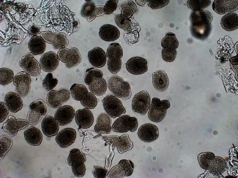 Protoscolices Echinococcus multilocularis microscopic photo of being released 库存照片