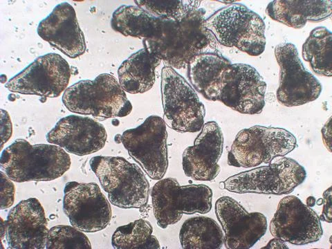 Protoscolices Echinococcus multilocularis microscopic photo of being released Stock Photos